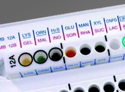X+V Factor Diagnostic disc